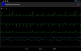 Bedside ECG Monitor screenshot 5