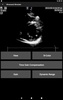 Basic - Transthoracic Echocardiography screenshot 4