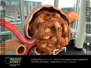 Insight Kidney screenshot 5