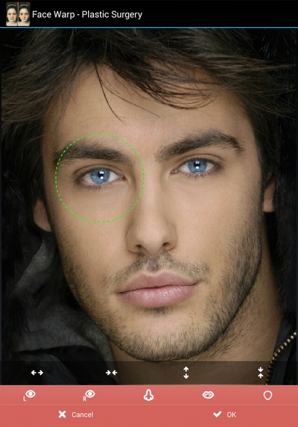 Face Warp - Plastic Surgery - Preview 9