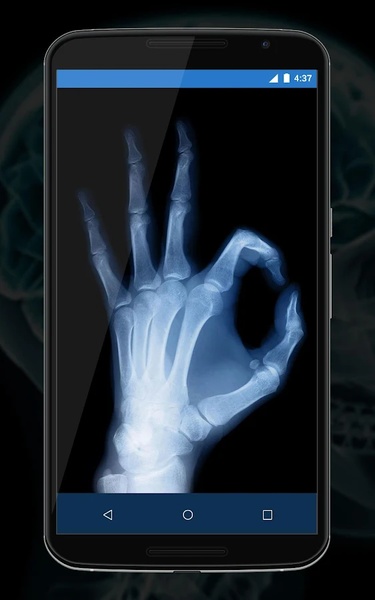 Xray Camera Scanner Prank - Preview 3