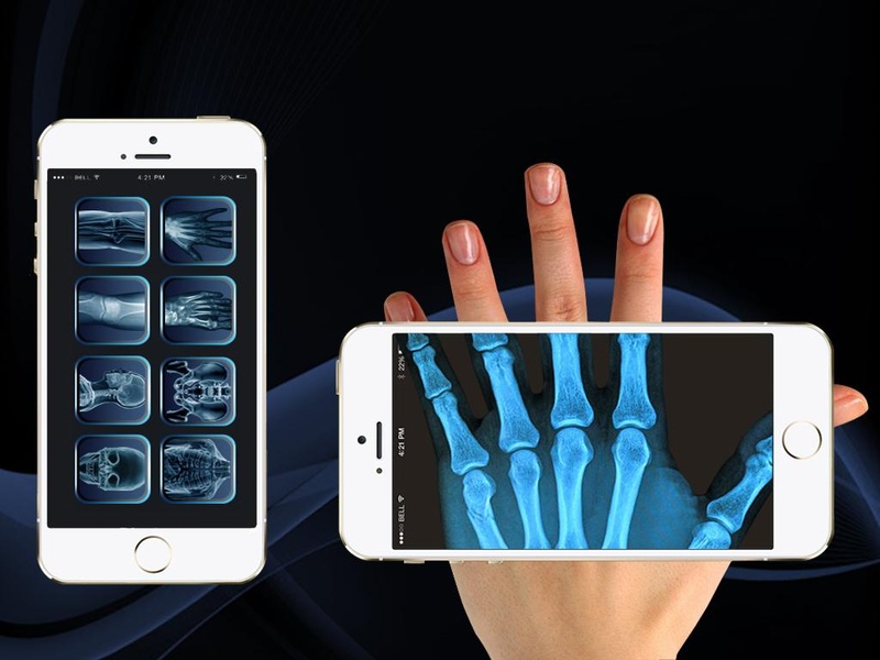 Xray Scan 2 - Preview 1