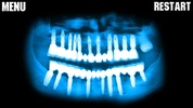 X-Ray Teeth Joke screenshot 2
