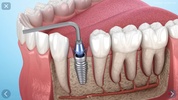 Dental 3D Illustrations screenshot 4