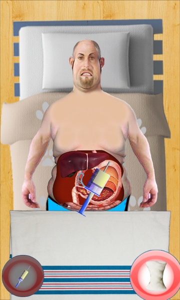 Stomach Surgeon - Preview 2