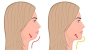 Double Chin Exercises screenshot 2