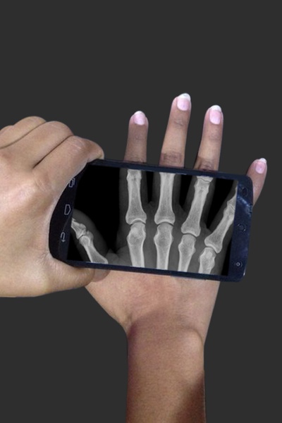 X_Ray Scanner - Preview 6