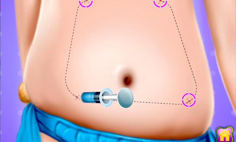 Simulator Plastic Surgery - Preview 2