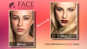 Blemishes Remover You Makeup screenshot 4