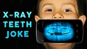 X-Ray Teeth Joke screenshot 1