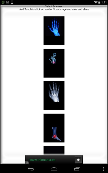 Xray Scanner Camera - Preview 5