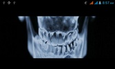 XRay screenshot 5