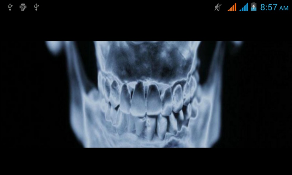 XRay - Preview 5