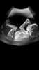 Ultrasound Scanner screenshot 2