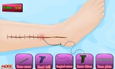 Toms leg surgery screenshot 10