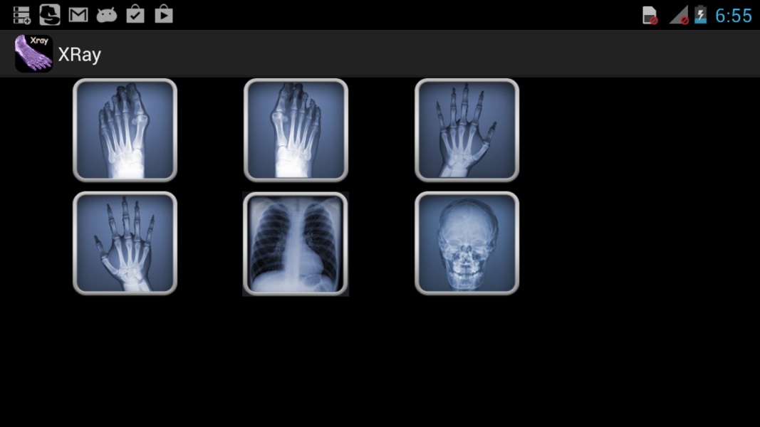 XRay - Preview 2