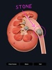 Urinary System screenshot 5