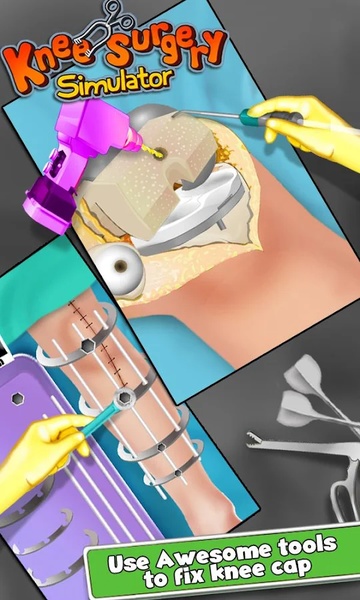 KneeSurgery - Preview 1