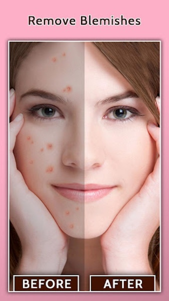 Face Blemish Remover - Preview 6