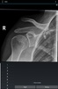 Radiology Flashcards: Free screenshot 1