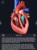 Heart Anatomy Pro. screenshot 3
