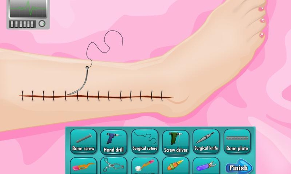 urgent docter leg surgery - Preview 9