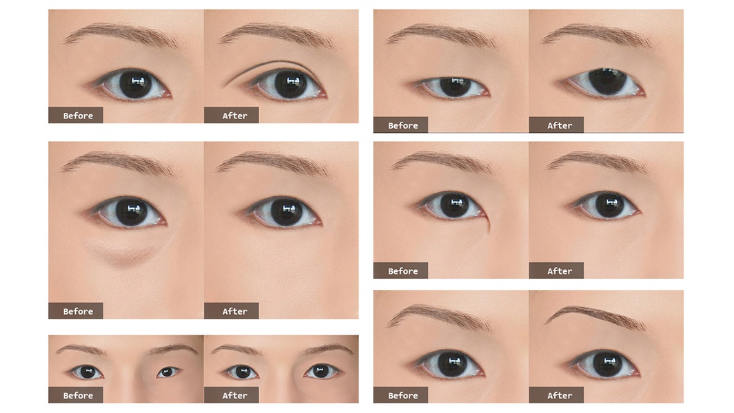 PhotoPlasticSurgeryProfessional - Preview 4
