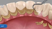 Clean Teeth Craze screenshot 3
