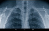 Xray Prank screenshot 2