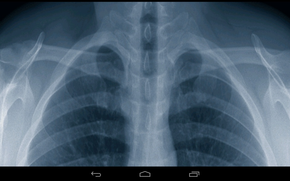 Xray Prank - Preview 1