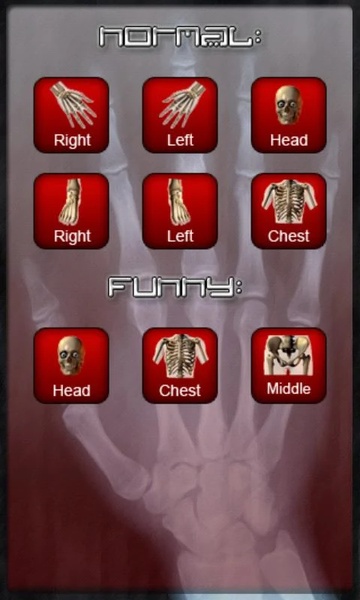 X-ray Scan - Preview 2