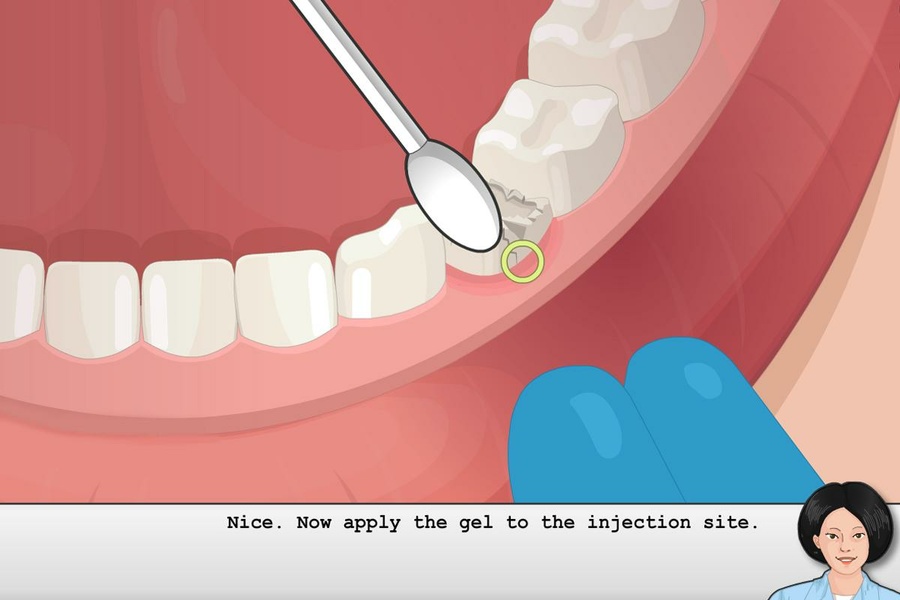 Jogar Operate Now! Dental Implant - Jogue Operate Now! Dental