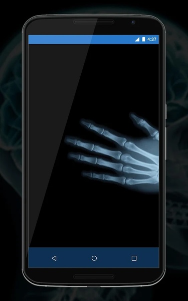 Xray Camera Scanner Prank - Preview 2