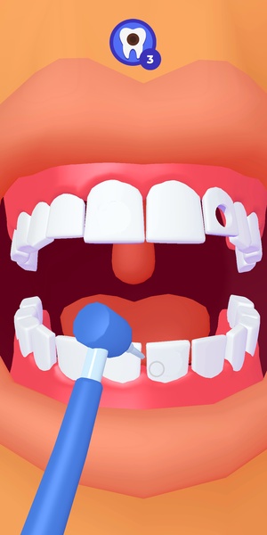 Mr Tooth - Preview 3