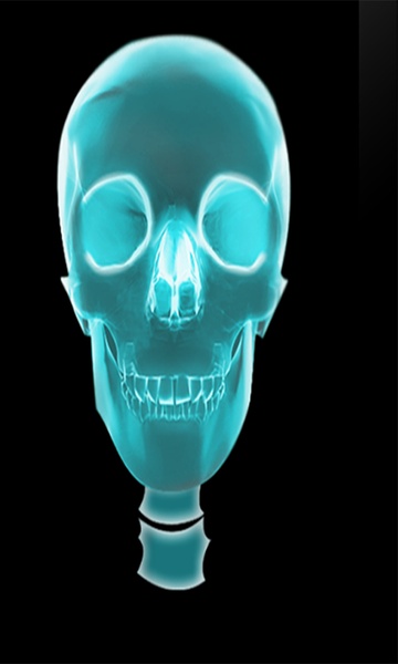 X-RayScanner - Preview 3