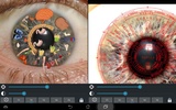 Eye Diagnosis screenshot 1