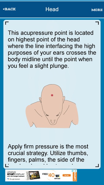 Accupressure Points - Preview 7
