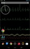 Bedside ECG Monitor screenshot 3