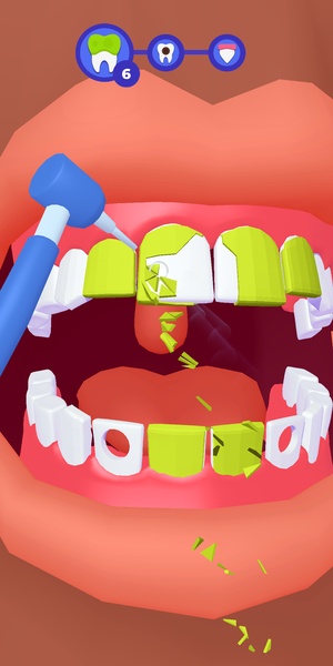 Mr Tooth - Preview 6