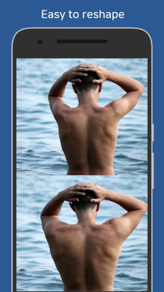 Body Plastic Surgery - Preview 6