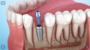 Dental 3D Illustrations screenshot 5