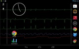 Bedside ECG Monitor screenshot 4