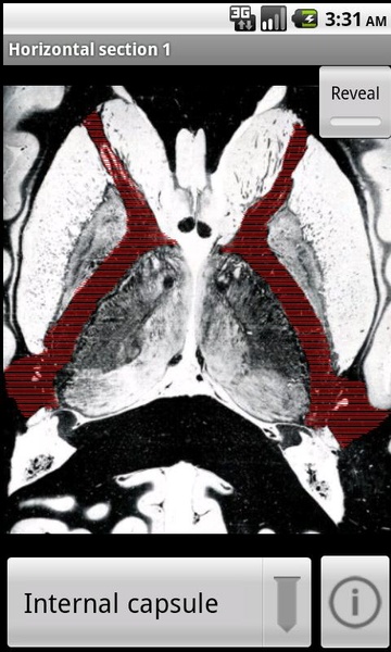 NeuroSlice - Preview 4