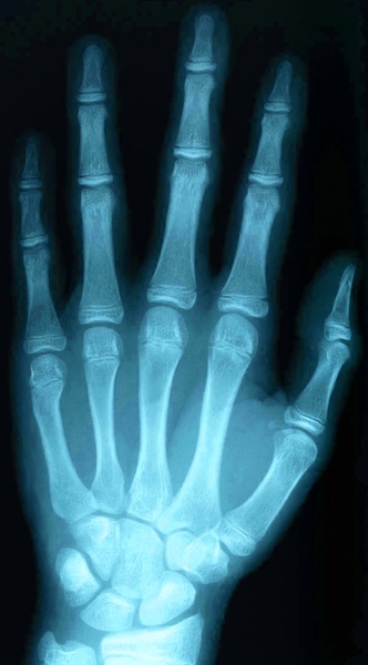 XRay - Preview 1