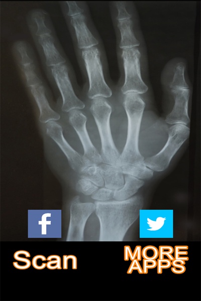Xray Cam - Preview 1
