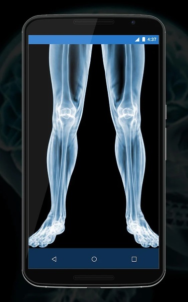 Xray Camera Scanner Prank - Preview 1