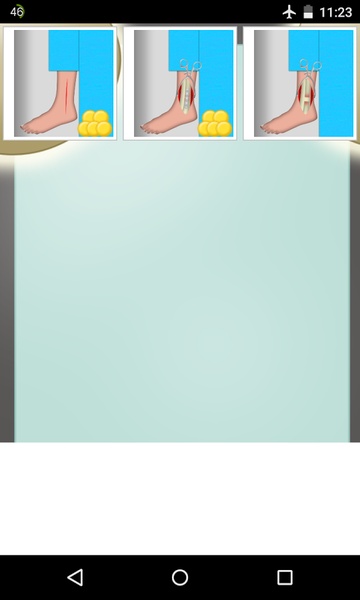 Ankle Surgery - Preview 2