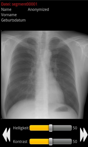 Minimal Dicom Viewer - Preview 2