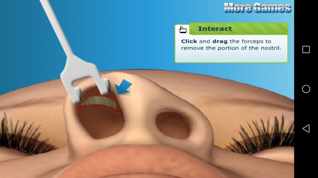 Nose Doctor - Preview 5