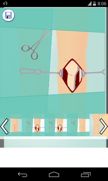 Orthopedic Games - Preview 1